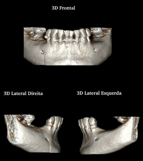 Exame Tomografia ortodôntica - Radiologia Odontológica em BH