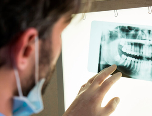 Lima Radiologia - exames odontológicos